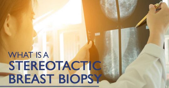 What Is a Stereotactic Breast Biopsy